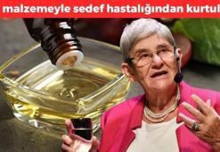Sedef, mantar ve egzamanın doğal ilacı! 5 dakika uygulamak yetiyor: Canan Karatay sırrını verdi, 1 damlası bile sedef, mantar ve egzamanın kökünü kurutuyor