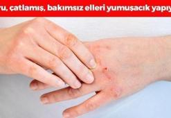 Soğuktan kuruyan, çatlamış, bakımsız elleri pamuk gibi yapıyor! Zeytinyağının içine 1 kaşık eklemek yetiyor, gece sürüp sabaha kadar bekletin