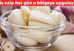 2 diş sarımsağı ezip her gün sürün! Saçkıran ve egzamaya iyi geliyor: 5 dakikada etki eden doğal karışım, doğal mantar ilacı
