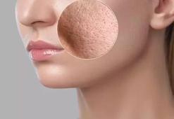 Yaz Sonunda Cilt Bakımında Neler Değişmeli? Uzmanlardan Tüyolar