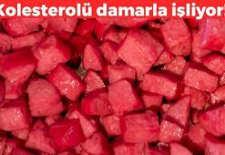 Kolesterolü damara ince ince işliyor! Kaşık kaşık yiyoruz ama damar tıkanıklığının en büyük sebebi, damarları kullanılmayacak hale getiriyor
