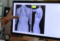 Uzmanında ailelere kritik uyarı! Yüzde 80'i ergenlikte ortaya çıkıyor