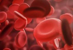 Kansızlık deyip geçmeyin! 4 kişiden birinde görülüyor