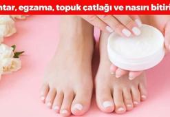 1 parça kullanmak yetiyor! Çatlamış, kuru ve sertleşmiş ayak topuklarını 5 dakikada bebek gibi yumuşacık yapıyor! Mantar, egzama ve nasırı da tarihe karıştırıyor