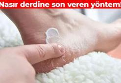 Nasırı 24 saatte yumuşatıp bitiriyor! 3 malzemeyi karıştırıp sürün: Bebek gibi cilt için düzenli kullanın