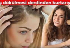 Kafanıza sürdüğünüz anda saçları coşturuyor! Kelleşmiş bölgeleri kapatıyor: Uzamayı hızlandırıyor, eski parlaklığını kazandırıyor