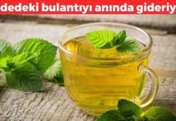 Hamile, yaşlı ve hastalardaki bulantıyı anında kesiyor! Mide bulantısını gideren doğal karışım