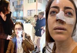 Kocasının sevgilisi sandığı kadına dehşeti yaşattı! Başını otomobilin kapısına sıkıştırdı