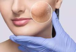 Resmen gençlik iksiri! 3 malzemeyle hazırlanıyor: 1 gecede 10 yaş gençleştiriyor, cildi bebek gibi yapıyor