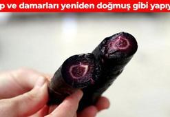 Suyunu sıkıp içen doktor yüzü görmüyor! Tek başına antioksidan deposu: Tıkalı damarları hortum gibi açıyor