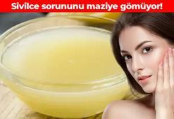 Sivilceye anında etki ediyor! Cildi bebek gibi yapıyor: Yüzünüzdeki aşırı yağı vakum gibi çekiyor