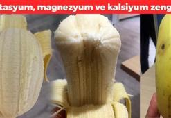 Kas kramplarının doğal tedavisi! Kemiklerin içine ince ince sızıyor: Magnezyum, kalsiyum ve mineral eksikliğini gideriyor