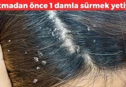 Egzamanın kökünü kurutuyor, kaşıntıyı önlüyor! Yatmadan önce 1 damla sürmek yetiyor