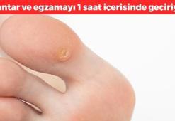 Nasırın kökünü kurutuyor! Mantar ve egzamayı 1 saat içerisinde geçiriyor: Ayakları anında pamuk gibi yapıyor, sadece 2 malzemeyle hazırlanıyor