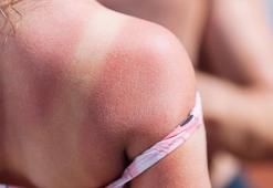 Cam kapalı olsa da güneş ışığı cildinize zarar verebilir mi?