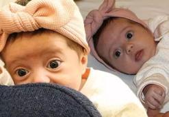 SMA Tip 1 hastası Miray bebeğin 1 milyon 870 bin dolara ihtiyacı var