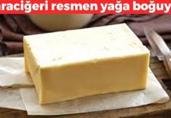 Karaciğeri yağa boğuyor! Böbrekleri diyalizin pençesine düşürüyor: Pilava koyanlar yediğine bin pişman oluyor