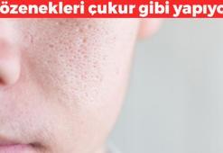 Cildi saniyesinde buruşturuyor! Göz kapaklarını sarkıtıp gözenekleri nokta nokta yapıyor: 1 gecede 10 yaş yaşlandırıyor