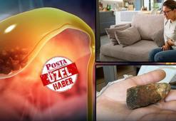 Golf topu büyüklüğünde olabilir! Doğum kontrol hapı kullananlar risk altında: Uzman isimden beslenme uyarısı