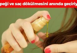 Şampuanın içine 5 damla koymak yetiyor! Kepeği, kuruluğu önleyip saçların avuç avuç dökülmesini engelliyor! Saçları ışıl ışıl yapıyor