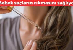 Saç ekim uzmanlarını işsiz bırakıyor! Bebek saçların çıkmasını sağlıyor: Avuç avuç dökülen saçlarınızı halat gibi güçlendirecek
