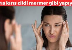Kağıt gibi buruşmuş cildi kolajene boğuyor! Mermer gibi cilt isteyenler denesin, botoksa para dökmeyin