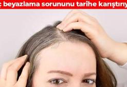 Yaşlansanız da saçınız beyazlamasın! Evde hazırlayabileceğiniz doğal tarif: Dökülmeyi durduruyor, kepekten eser bırakmıyor
