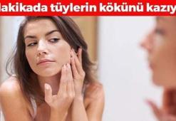 Kıl köklerini kurutuyor! 5 dakikada etki ediyor: Ağda, ip, cımbız ve lazeri unutturuyor! İstenmeyen tüylerden kurtulmanın en doğal yolu