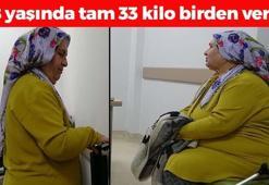 58 yaşındaki kadın tam 33 kilo verdi! 131 kilodan 98'e düştü, bastonunu fırlattı! Mum gibi erimenin sırrı meğer gözümüzün önündeymiş