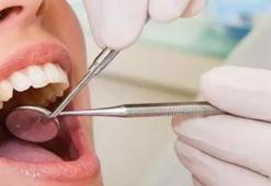 Diş kanal tedavisi oruç bozar mı? Oruçluyken kanal tedavisi orucu bozar mı? Diyanet bilgisi