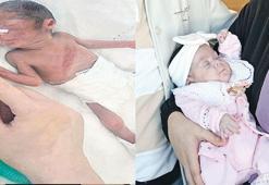 Mucize bebek