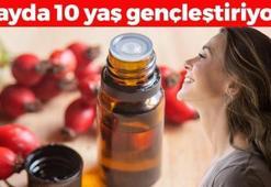 Botoks iğnesinden bile daha etkili! 1 ay boyunca süreni 10 yaş gençleştiriyor, egzama, sedef ve mantarı kurutup cildi parıl parıl parlatıyor!