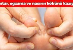 Ayak mantarının kökünü kurutuyor! Egzama, nasır ve mantarı tarihe gömüyor, ayakları pamuk gibi yumuşacık ve pürüzsüz yapıyor!