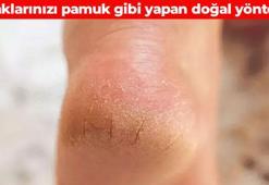 Topuktaki çatlakları silip süpürüyor! Taş gibi sertleşmiş ayakları pamuk gibi yapıyor