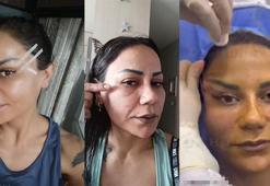 220 bin TL'ye estetik yaptırdı! İstediği olmayınca hayatı kabusa döndü