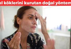 Kaş bıyık derdine son veriyor! Kıl köklerini kurutuyor: 2 malzemeli doğal epilasyon