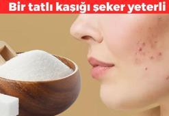 Bir tatlı kaşığı şeker sivilcelerin kökünü kurutuyor! Haftada birkaç kez uygulamak yeterli: Peeling etkisi yapıyor, ciltteki fazla yağı ve kirleri söküp atıyor