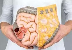 Genç yaşta görülme sıklığı arttı! Kalın bağırsak kanserine dikkat