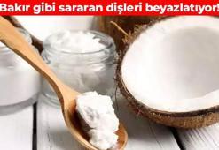 Sigaradan sararan dişleri inci gibi yapıyor! Ağız kokusunu tarihe karıştırıyor, nefesi ferahlatıyor