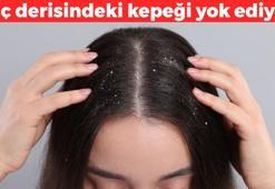 Saç derisindeki kaşıntıyı yok ediyor! Mantarın kökünü kurutuyor: 1 damlası serum etkisi gösteriyor