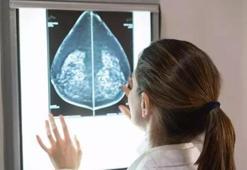 Tanı konulan yaklaşık her 4 kadın kanserinden biri meme kanseri
