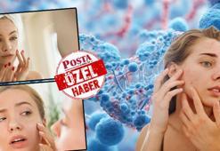 Cilt bakım maskesinde 'salmonella' tehlikesi! Dermatoloji uzmanı sosyal medya tuzağına karşı uyardı
