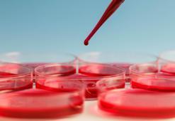 Erkeklerde daha sık görülüyor