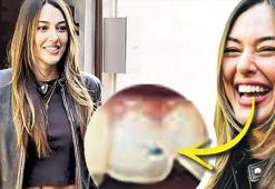 Dişinde taş belinde anahtar!