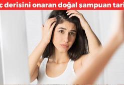 Saç derisini onarıyor! Kepek, egzama ve mantarın kökünü kurutuyor: 2 malzemeli doğal şampuan