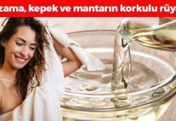 Saçtaki kepek, mantar ve egzamanın kökünü kurutuyor, 1 ayda 5 santim uzatıyor! En pahalı kremlerden bile daha etkili: 1 kaşığı saçları ışıl ışıl parlatıyor