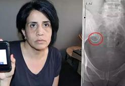 Zorla evlendirildi, hayatı kabusa döndü: Bunları hak edecek ne yaptım