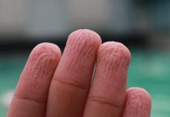 Parmak buruşmasının sebebi belli oldu! Suda geçen sürenin uzamasıyla belirginleşiyor