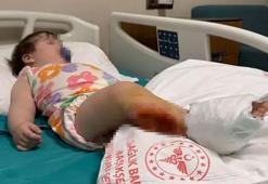 1 yaşındaki bebek, babaannesinin gözü önünde dehşeti yaşadı!