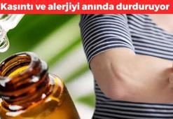 Kaşıntı ve alerjinin kökünü kazıyor! 1 damla sürmek yeterli: Yaraları saatler içerisinde iyileştiriyor, böcek ısırıklarını anında rahatlatıyor